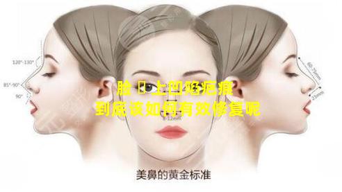 脸 ☘ 上凹陷疤痕到底该如何有效修复呢